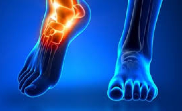 Σύνδρομο τάρσιου σωλήνα